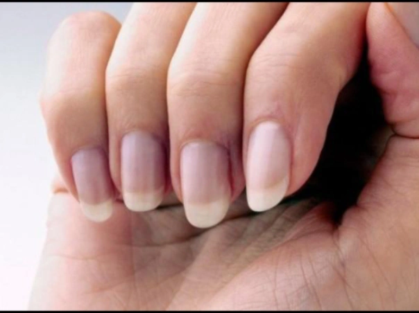 Pale or Very Light-Colored Nails